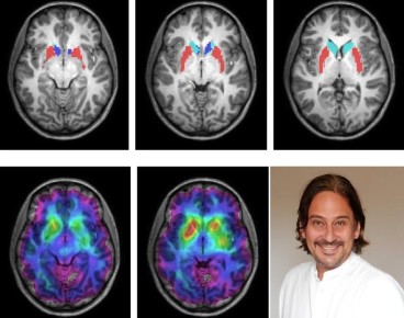 ���� �������� ��������, ������� ����� ��������� ��� ����